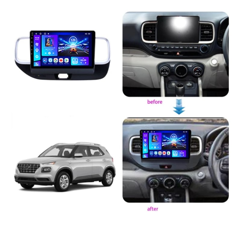 Sistem multimedia audio BORD 22-622: 9-inch HYUNDAI VENUE 2019-2024 - Q7